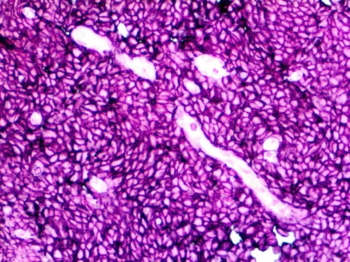 IHC of CD45 on an FFPE Tonsil Tissue